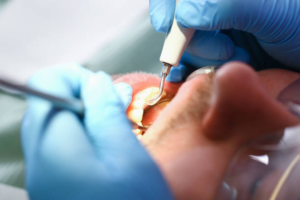 Best Walk-In Emergency Dental Services in Lufkin, TX